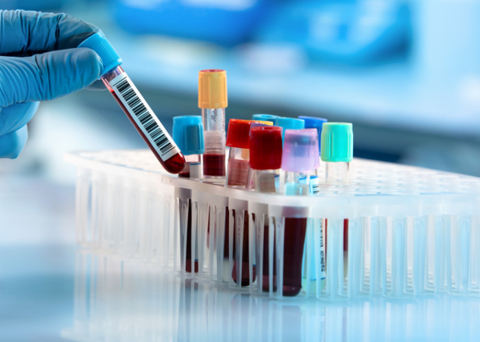Molecular Testing
